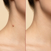 GFOUK Removal Patch